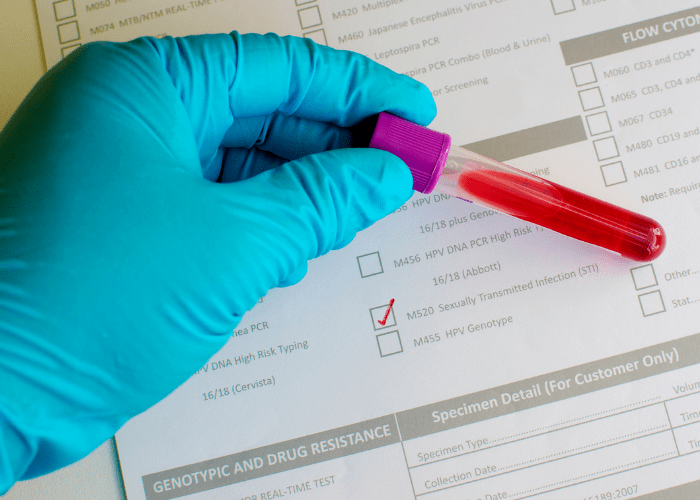 What Are the Signs You Need an STD Test?